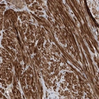 Immunohistochemical staining of human prostate shows strong cytoplasmic positivity in smooth muscle cells.
