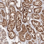 Anti-DCTD Antibody