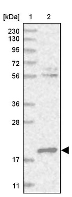 Lane 1: Marker [kDa] 230, 130, 95, 72, 56, 36, 28, 17, 11_br/_Lane 2: Human cell line RT-4