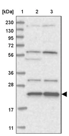 Lane 1: Marker [kDa] 230, 130, 95, 72, 56, 36, 28, 17, 11_br/_Lane 2: Human cell line RT-4_br/_Lane 3: Human cell line U-251MG sp