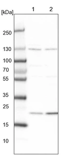 Lane 1: NIH-3T3 cell lysate (Mouse embryonic fibroblast cells)_br/_Lane 2: NBT-II cell lysate (Rat Wistar bladder tumour cells)