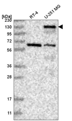 Anti-PALLD Antibody