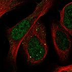 Immunofluorescent staining of human cell line U-2 OS shows localization to nucleoplasm & vesicles.