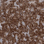 Anti-PLA2G12A Antibody