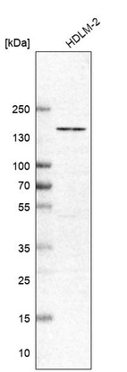 Western blot analysis in human cell line HDLM-2.
