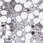 Anti-ARAP2 Antibody