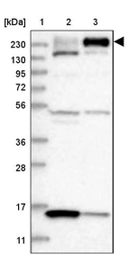 Lane 1: Marker [kDa] 230, 130, 95, 72, 56, 36, 28, 17, 11_br/_Lane 2: Human cell line RT-4_br/_Lane 3: Human cell line U-251MG sp