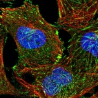 Immunofluorescent staining of human cell line U-2 OS shows localization to actin filaments & focal adhesion sites.