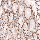 Immunohistochemical staining of human stomach shows moderate nuclear membrane positivity in glandular cells.