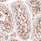 Immunohistochemical staining of human testis shows moderate to strong nuclear and nuclear membrane positivity in cells in seminiferous ducts.
