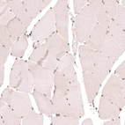 Immunohistochemical staining of human skeletal muscle shows only weak nuclear positivity in striated muscle fibers.