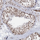 Anti-PLRG1 Antibody