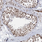 Anti-PLRG1 Antibody