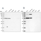 Western blot analysis using Anti-PLRG1 antibody HPA035932 (A) shows similar pattern to independent antibody HPA035931 (B).