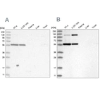 Western blot analysis using Anti-PLRG1 antibody HPA035932 (A) shows similar pattern to independent antibody HPA035931 (B).