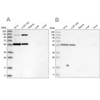 Western blot analysis using Anti-PLRG1 antibody HPA035931 (A) shows similar pattern to independent antibody HPA035932 (B).