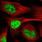 Immunofluorescent staining of human cell line U-2 OS shows localization to nuclear speckles.