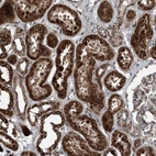 Anti-NDUFA2 Antibody