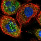 Immunofluorescent staining of human cell line A-431 shows localization to cytosol & vesicles.