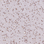 Immunohistochemical staining of human cerebral cortex shows moderate nuclear positivity in neurons.