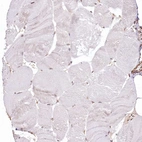 Immunohistochemical staining of human skeletal muscle shows no positivity in myocytes as expected.