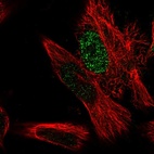 Immunofluorescent staining of human cell line U-251 MG shows localization to nucleoplasm.