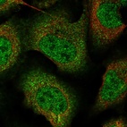 Immunofluorescent staining of human cell line U-2 OS shows localization to nucleoplasm & cytosol.