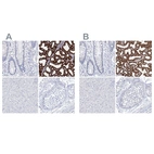 Anti-CSN3 Antibody