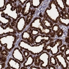 Immunohistochemical staining of human lactating breast shows strong cytoplasmic positivity in glandular cells.