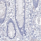 Immunohistochemical staining of human colon shows no positivity in glandular cells as expected.
