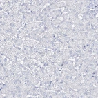 Immunohistochemical staining of human liver shows no positivity in hepatocytes as expected.