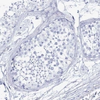 Immunohistochemical staining of human testis shows no positivity in cells in seminiferous ducts as expected.