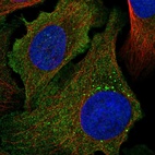 Immunofluorescent staining of human cell line U-2 OS shows localization to plasma membrane.