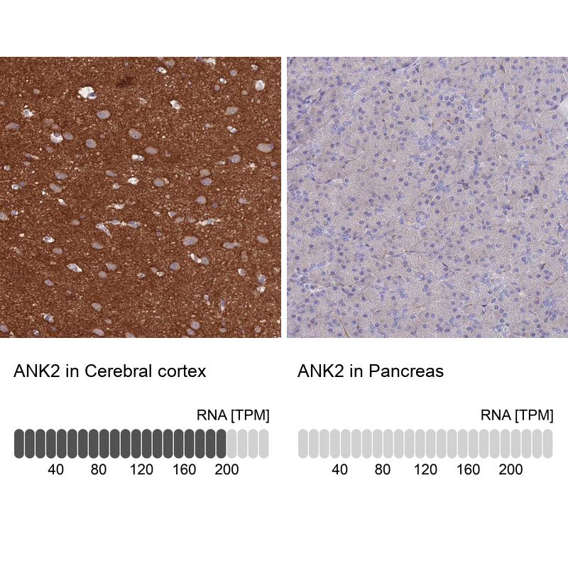 Anti-ANK2 Antibody