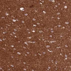 Immunohistochemical staining of human cerebral cortex shows high expression.