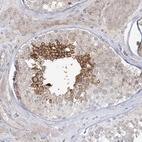 Anti-ADAMTS12 Antibody