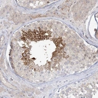Anti-ADAMTS12 Antibody
