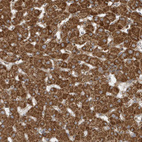 Immunohistochemical staining of human Liver shows strong granular cytoplasmic positivity in hepatocytes.
