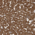 Immunohistochemical staining of human Liver shows strong granular cytoplasmic positivity in hepatocytes.