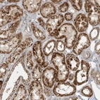 Immunohistochemical staining of human Kidney shows strong granular cytoplasmic positivity in cells in tubules.