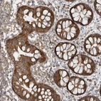 Immunohistochemical staining of human Rectum shows strong granular cytoplasmic positivity in glandular cells.