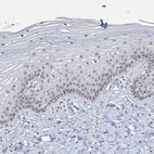Immunohistochemical staining of human cervix, uterine shows weak nuclear positivity in squamous epithelial cells.