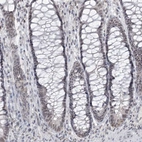 Immunohistochemical staining of human rectum shows moderate nuclear positivity in glandular cells.
