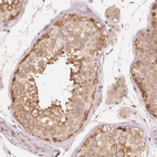 Immunohistochemical staining of human testis shows moderate cytoplasmic-membranous positivity in cells in seminiferous ducts and Leydig cells.