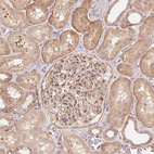 Immunohistochemical staining of human kidney shows moderate cytoplasmic positivity in cells in tubules and cells in glomeruli.