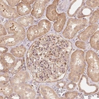 Immunohistochemical staining of human kidney shows moderate cytoplasmic positivity in cells in tubules and cells in glomeruli.