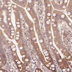 Immunohistochemical staining of human duodenum shows moderate cytoplasmic positivity in glandular cells.