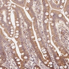 Immunohistochemical staining of human duodenum shows moderate cytoplasmic positivity in glandular cells.
