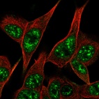 Immunofluorescent staining of human cell line SH-SY5Y shows localization to nuclear speckles.