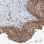 Anti-REPIN1 Antibody